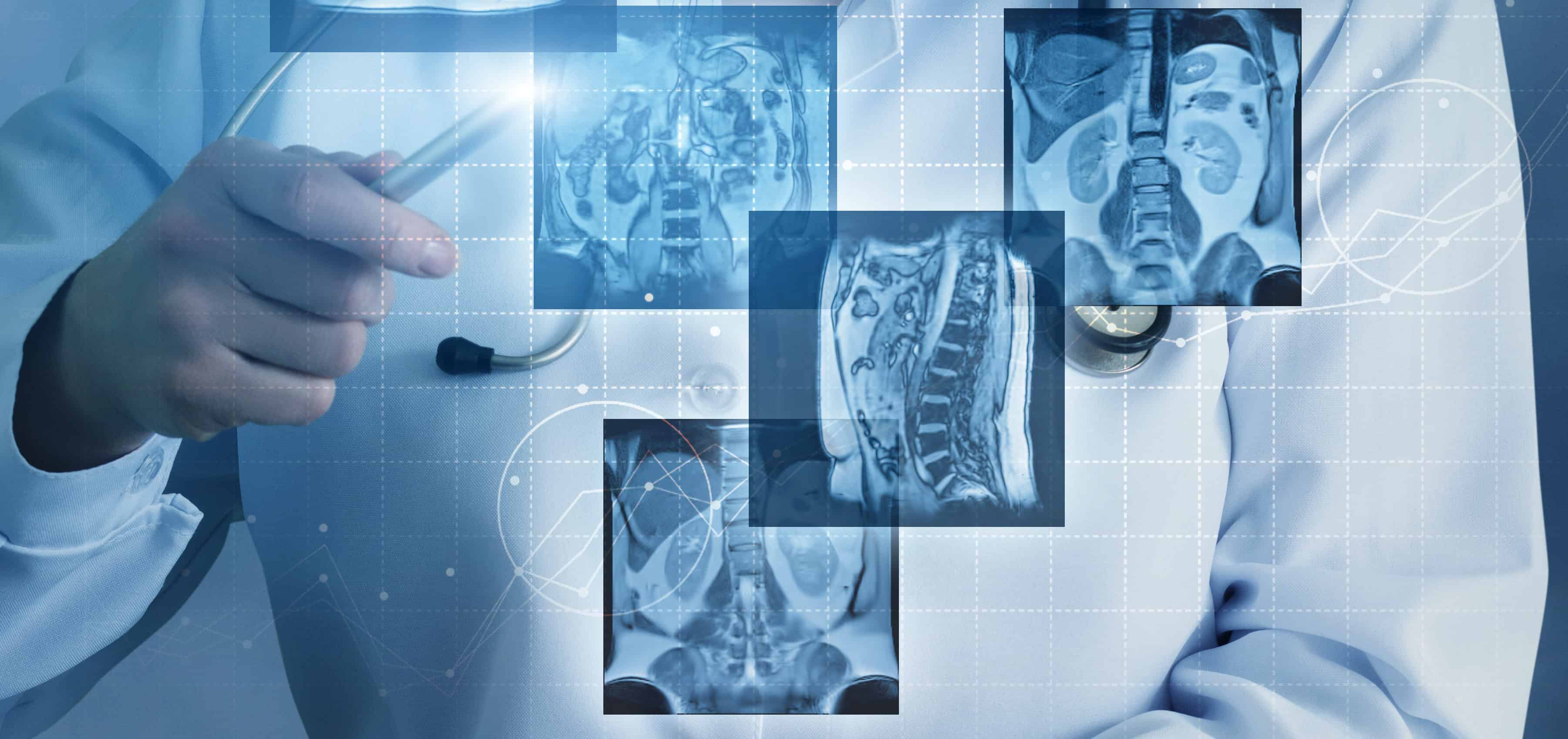 Diagnostica radiologica